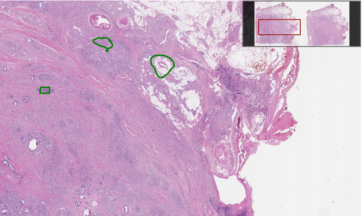 Whole image histology slide